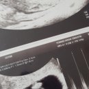 맘스프링산후조리원 이미지