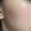 프라임뷰티 | 마미케어 펜타프라임 뷰티 디바이스 내돈내산 사용 솔직 후기 (광고협찬X)