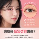 하이봄성형외과의원 이미지