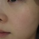 (주)블루라인 | 악센다 블루블러드 앰플 + 니기미봄므 7일 내돈내산 후기 | 붉은기 진정 피부톤 정리 미백라인 공구