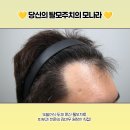 헤어라인