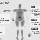 뱃살 그대로 두면 생기는 ‘치명적인’ 몸의 변화 5가지 이미지