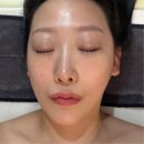 엔파로 | 여의도피부과 엔파인더스 엔진 리프팅 얼굴 3부위 솔직 후기+