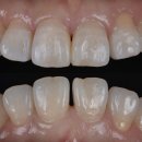 굿모닝뉴욕치과의원 이미지