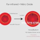 체내 산화질소량(NO) 증가가 암 치료에 미치는 영향 이미지
