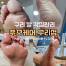 경춘로1886번길 5-1 | 구리 발 각질 관리 아기발로 뽀송하게 케어 받은 후기 푸스케어 구리점