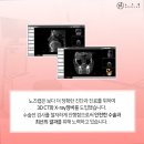 노즈랩의원 이미지