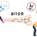 골다공증 예방, 운동이 최고…썬크림 바르면 효과 떨어진다? 이미지