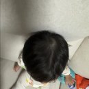 아기 두상 비대칭이 걱정된다면? 스피두 웹앱 사용 후기