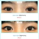 에스라인