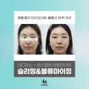 선이고운의원 | 압구정 이유클리닉 레디어스 &amp; 비탈라이트 시술 후기, 옆볼부터 팔자, 마리오네트까지