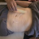 귀족피부관리 | 일산 정발산 피부관리 추천, 수뷰티&귀족다이어트에서 받은 복부 고주파·캐비테이션 관리 후기
