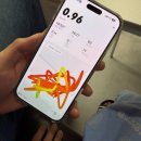 강서열린점 | 교통사고 골절수술 후 입원 발산역 면력한방병원 강서점 입원 후기