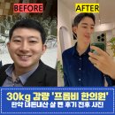 30kg 살 빼는 한약 전후 사진 강남 프롭비한의원 내돈후기