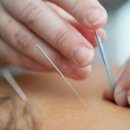 바른침 한의원 이미지