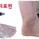 명현 이미지