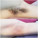 대전브라질리언왁싱 그루밍