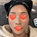 대전 피부과 내돈내산 스킨보톡스 시술 후기