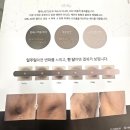 아띠조이 - 순천시 영동길 41 | 장유 멜라닌 케어 김해 색소침착 케어 아띠 방문 후기