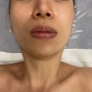 지에스25 다산리버점 | 다산피부샵 올가뷰티 다산 신안점 물광관리 후기