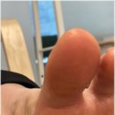 루이바이오 이미지