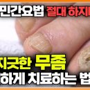 지긋지긋한 무좀균 박멸하는 법 / EBSDocumentary 이미지