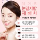 제이원성형외과 네이버블로그