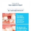 튼튼치과기공소 네이버블로그
