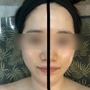 씨유 춘천후평동광점 | 춘천 윤곽관리 추천 연아랩 스킨 앤 바디 내돈내산