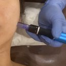 떡보의하루구미점 | 구미 환절기 스킨부스터 피부관리 / 미노브에스테틱