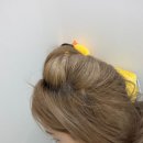 모건휴먼피부과의원 | 내돈내산 휴먼피부과의원 잠실 원형탈모 주사 맞은 후기