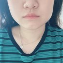 수암치과의원 | 대학병원급 매복 사랑니 발치 후기 (2023.05.19)