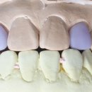 지안치과기공소 이미지