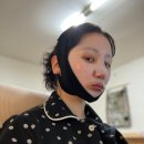 중앙 메디케어 | 이중턱 홈케어로 턱살 정리ㅣ 땡김이 솔직후기ㅣ비포애프터