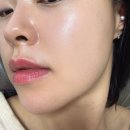 불독 | [서면피부과 반쪽주사 후기] 불독살 고민해결 2주차 전후비교