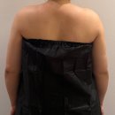 110 | 팔뚝지방흡입후기 110일 경과 지흡전후 차이와 회복 과정 비교