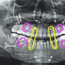 아무나사게 이미지