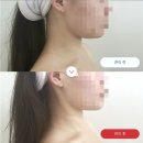 노형동 피부관리 리프팅, 즉각효과 ‘스킨어스에스테틱’ 솔직 후기 (매장, 가격, 주차, 비포앤에프터)