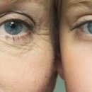 탈라코스메틱 이미지