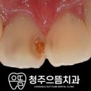 청주으뜸치과의원 이미지