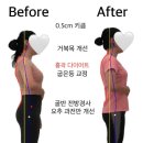 소은한의원 | 아산 두통 운동, 10년 통증 2주만에 사라졌어요