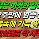 만성염증 원인 증상 없애는 방법 만성염증에좋은음식 이미지