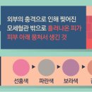 멍라이프 이미지