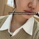 명동역피부과한의원 탄력리프팅 동안침 3회차 후기 + 비용&amp;관리팁 총정리!