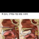 난 코로나걸리기싫은 이유중 제일큰게 검사방법때문임.. 이미지