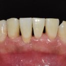 아트리움치과기공소 이미지