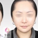 브이라인 네이버블로그
