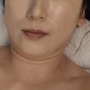 [내돈 내산] 역삼피부관리 여리지스파 역삼점 작은얼굴 관리 후기