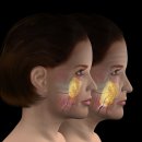 피써티원 | 삼성역피부과 울쎄라피 프라임 볼패임 없는 피부과 찾는법