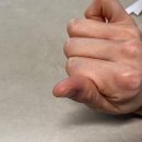 힐더스킨 | 주부습진관리법 비판텐 시카라놀린크림 후기